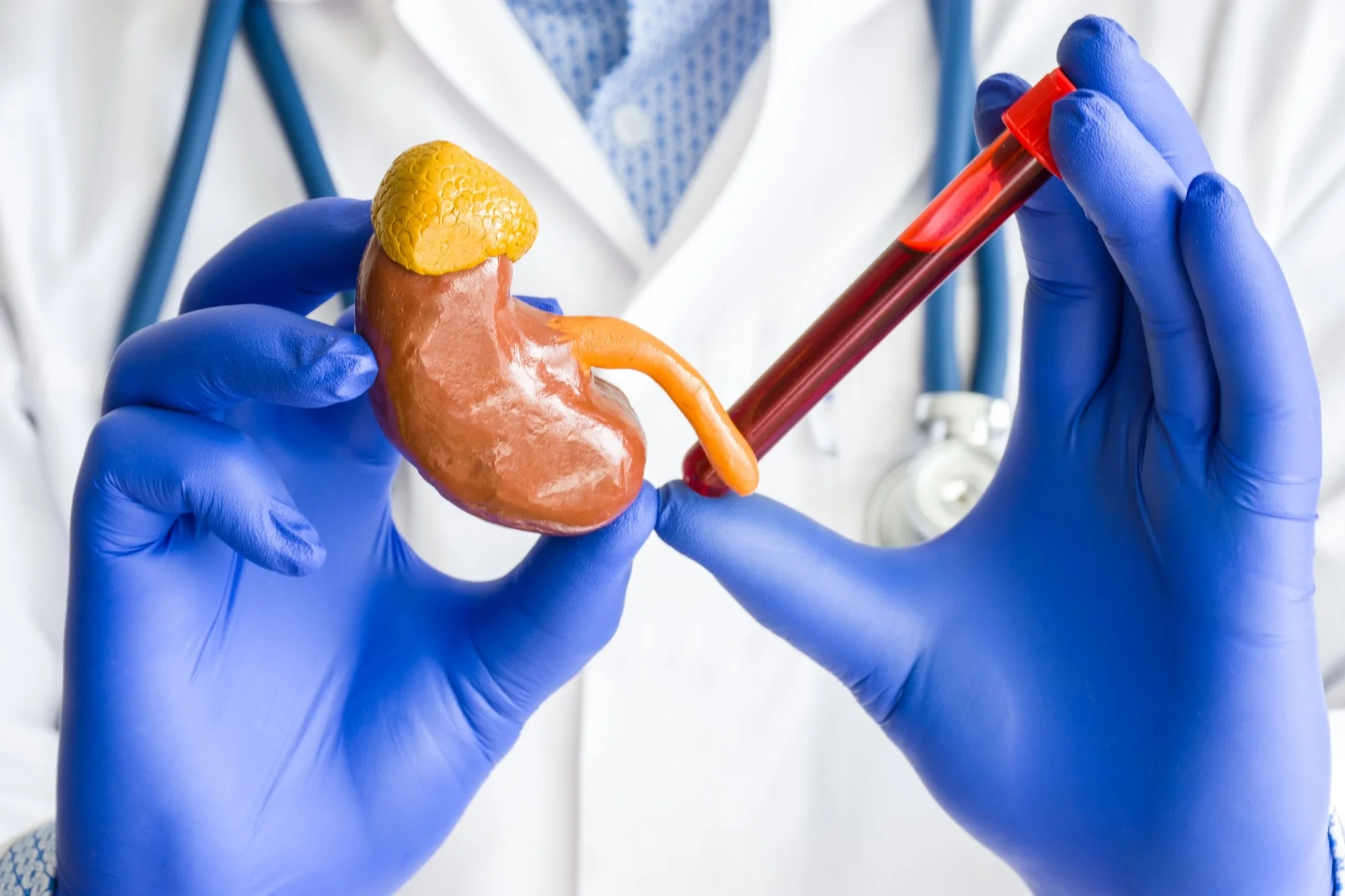 Homeopathic solutions for Kidney Disorder